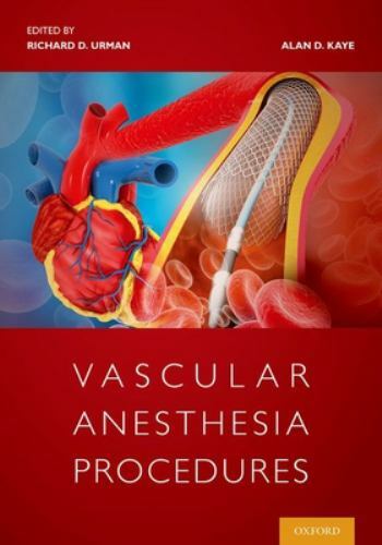 Vascular Anesthesia Procedures, Paperback by Urman, Richard D., M.D. (EDT); K…