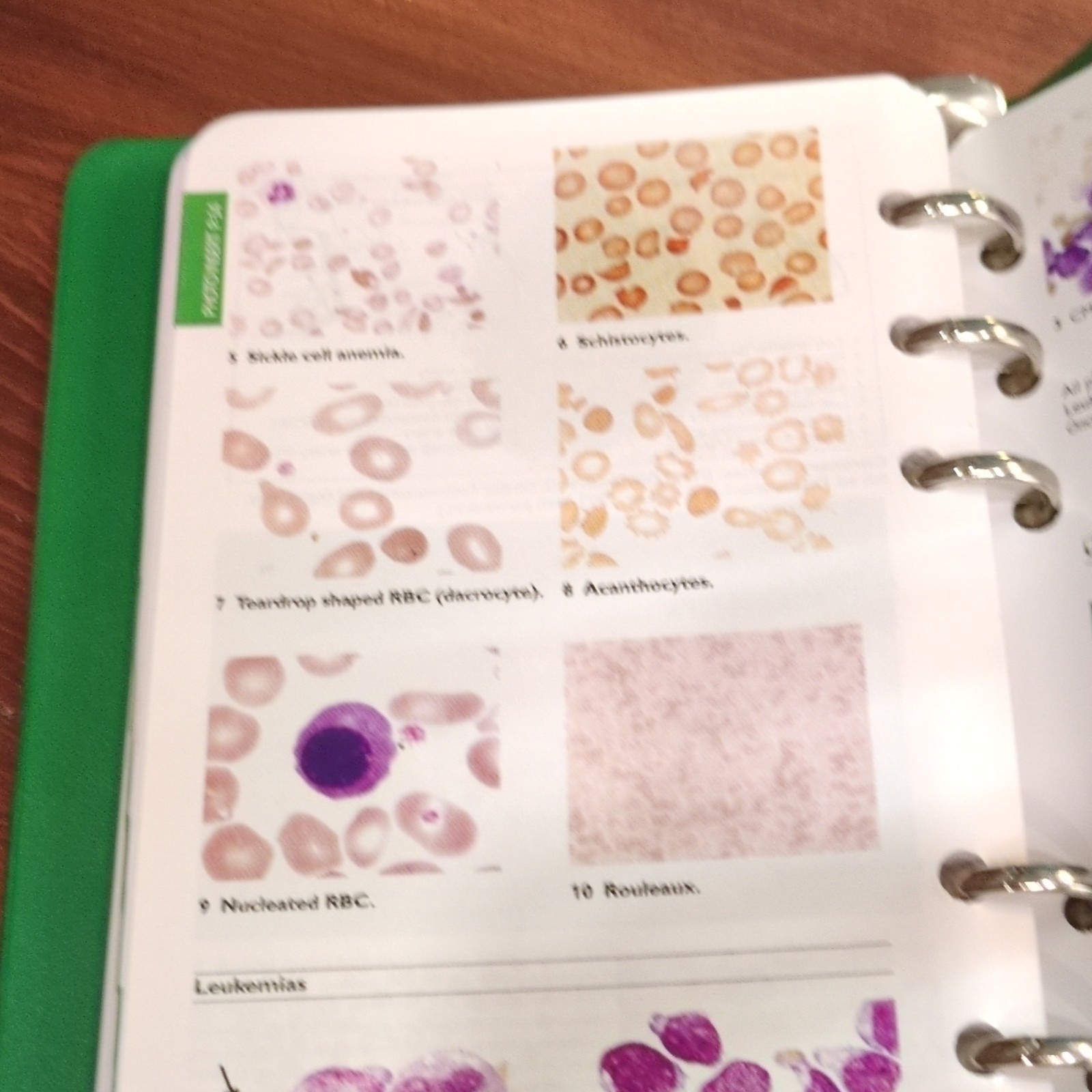 Wolters Kluwer Fourth Edition Ringbound Pocket Medicine Marc S. Sabatine