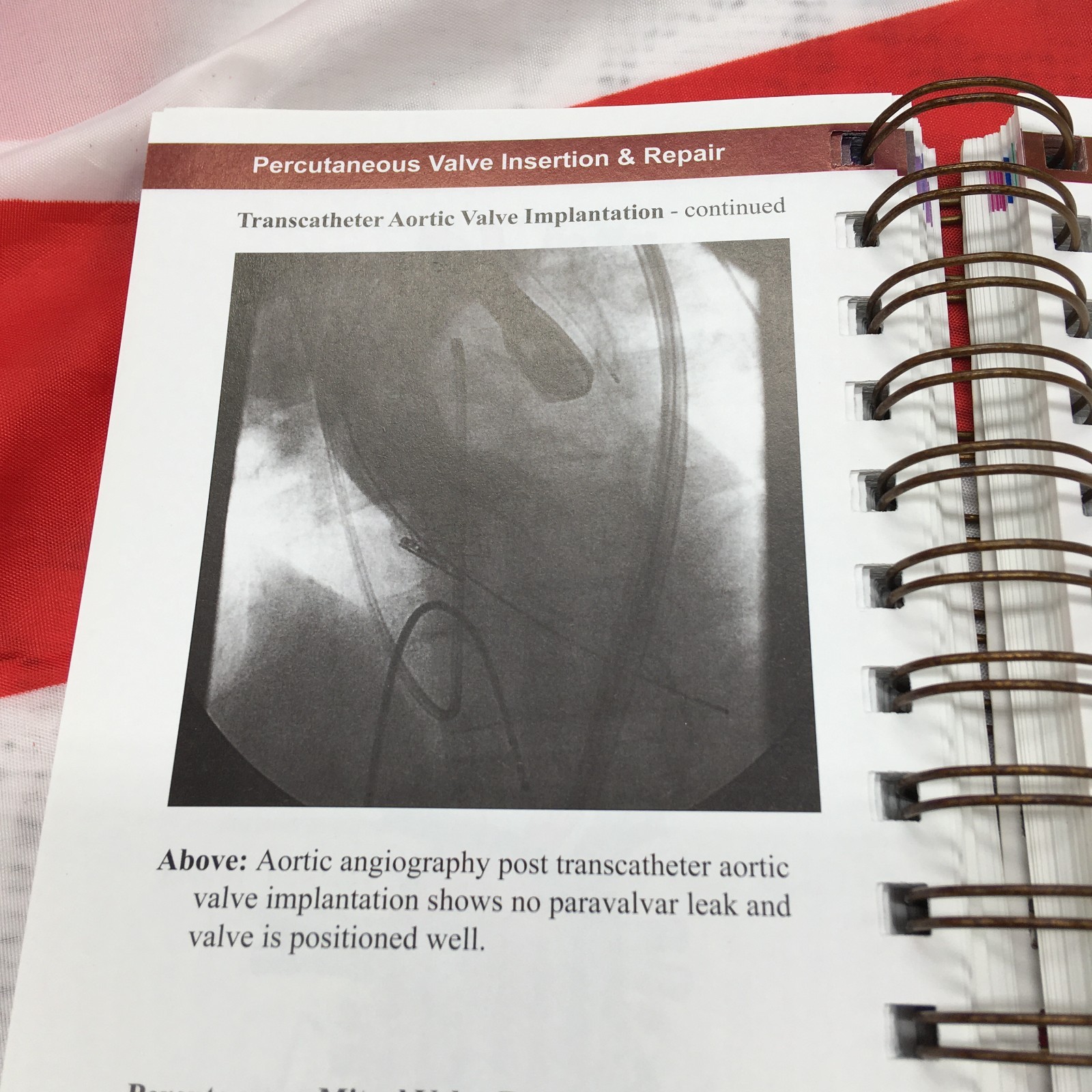 Illustrated Field Guide to Congenital Heart Disease and Repair – 3rd Edition