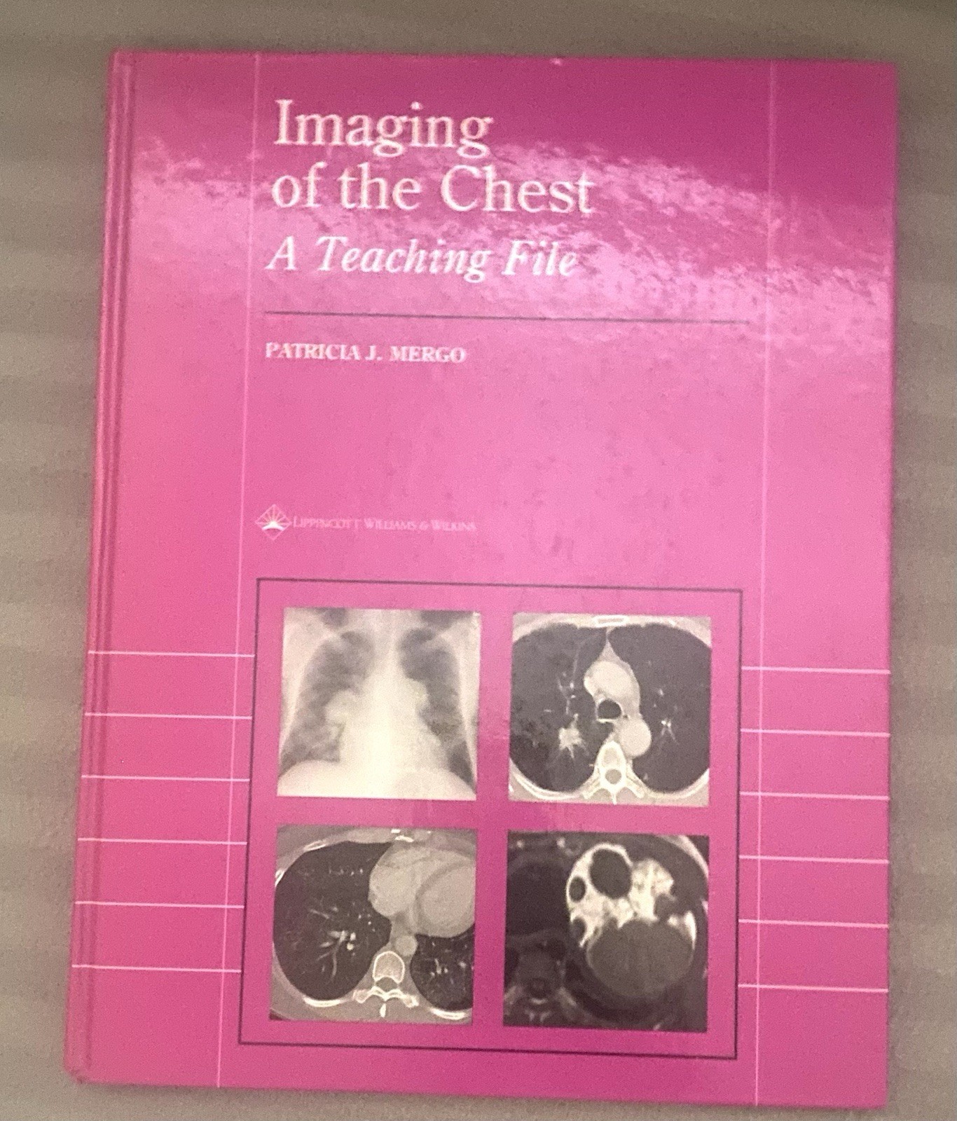 Lww Teaching File Ser.: Imaging of the Chest : A Teaching File by Patricia J….